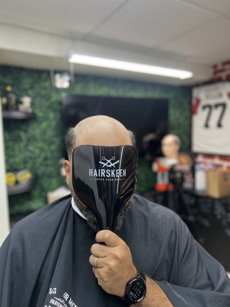 Premier Hair Replacement gallery photo