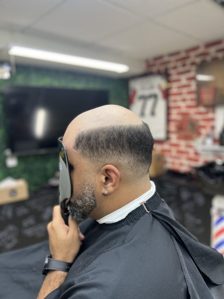Premier Hair Replacement gallery photo