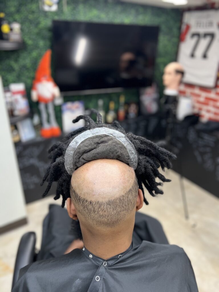 Premier Hair Replacement gallery photo