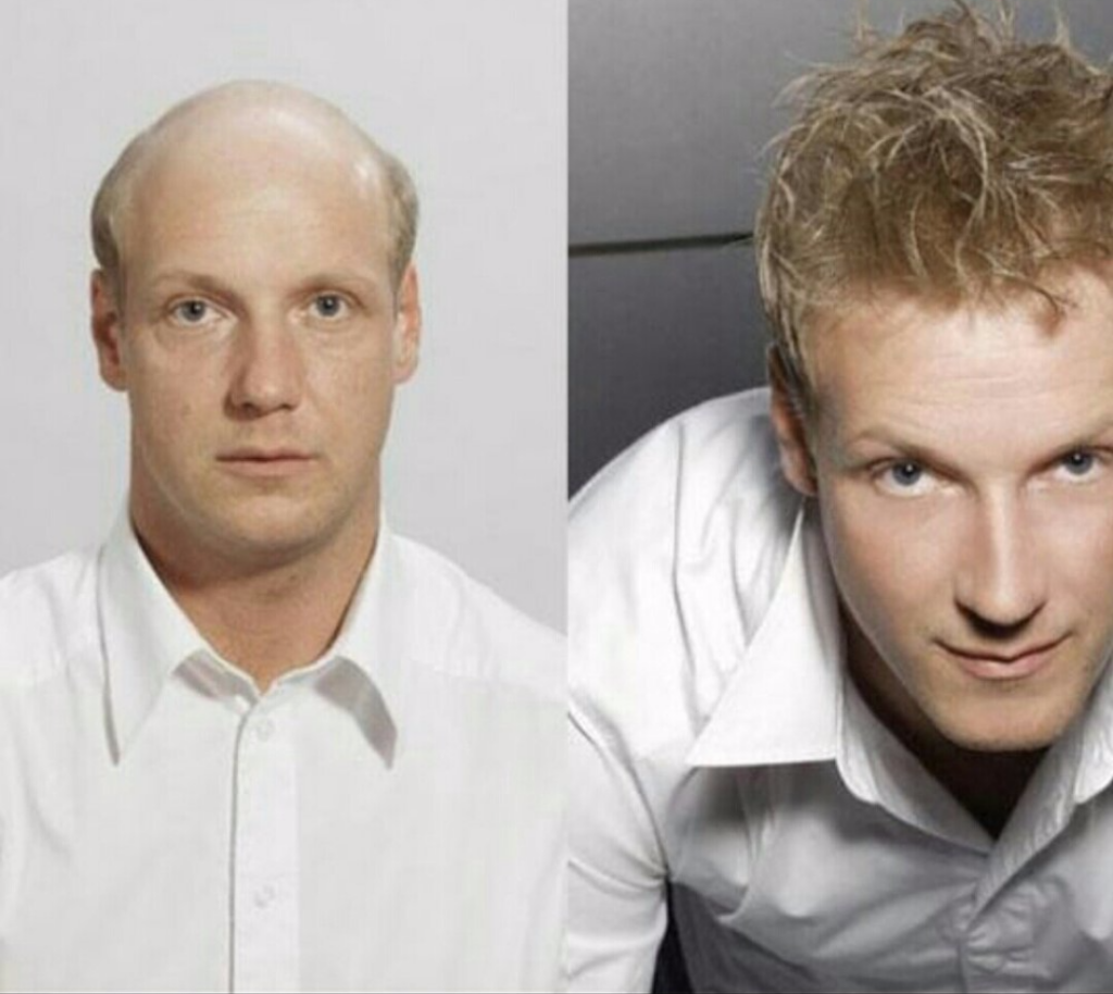 Wayne’s Concept Hair Replacement gallery photo