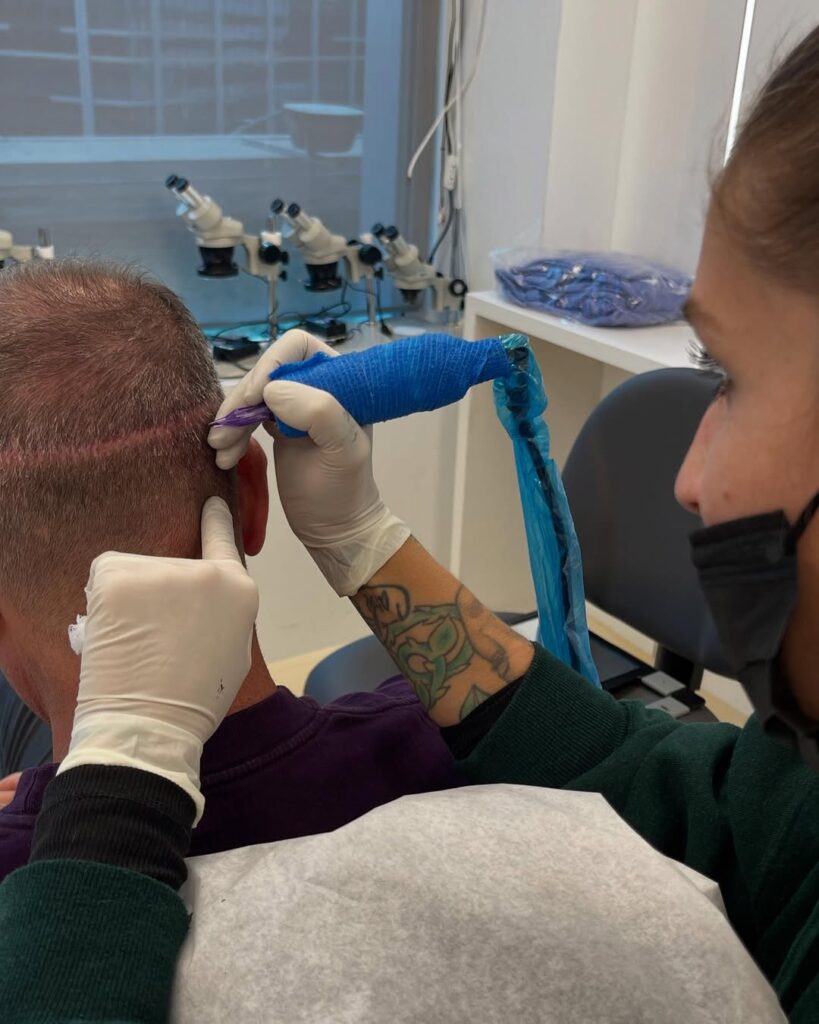 Ziering Medical Hair Restoration Connecticut gallery photo