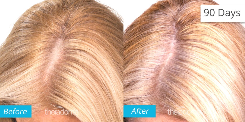 Elite Hair Transplant Centers gallery photo