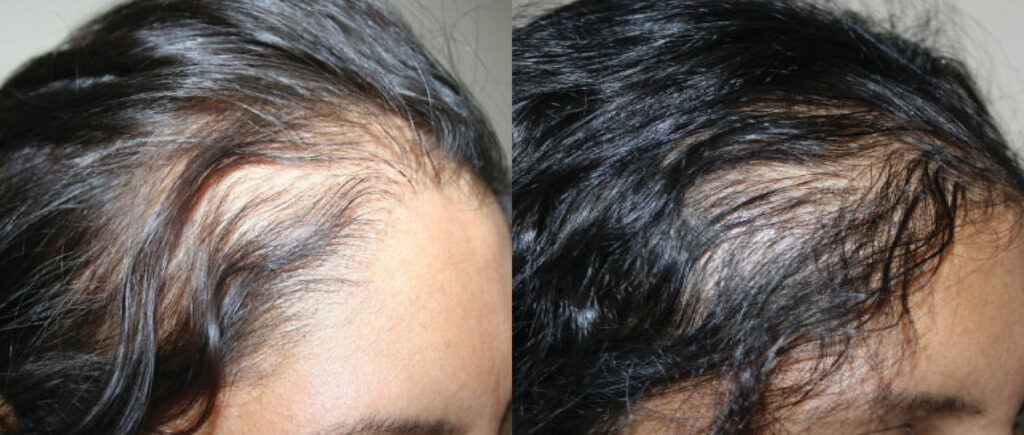 Elite Hair Transplant Centers gallery photo