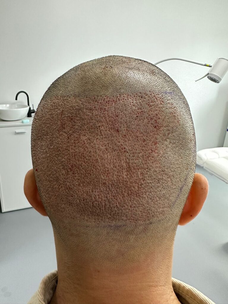 Arta Hair Clinic gallery photo