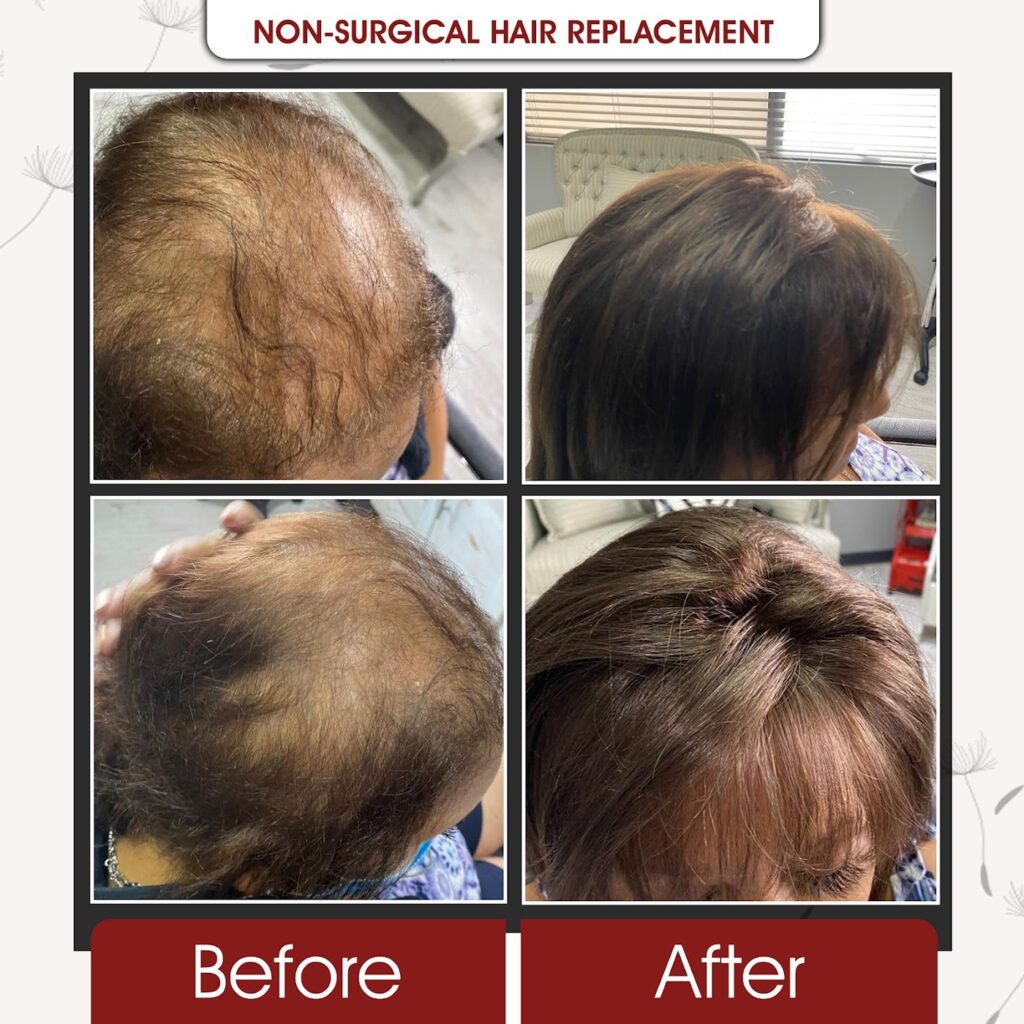 Grace Follicles (Durban Hair Loss Clinic) gallery photo