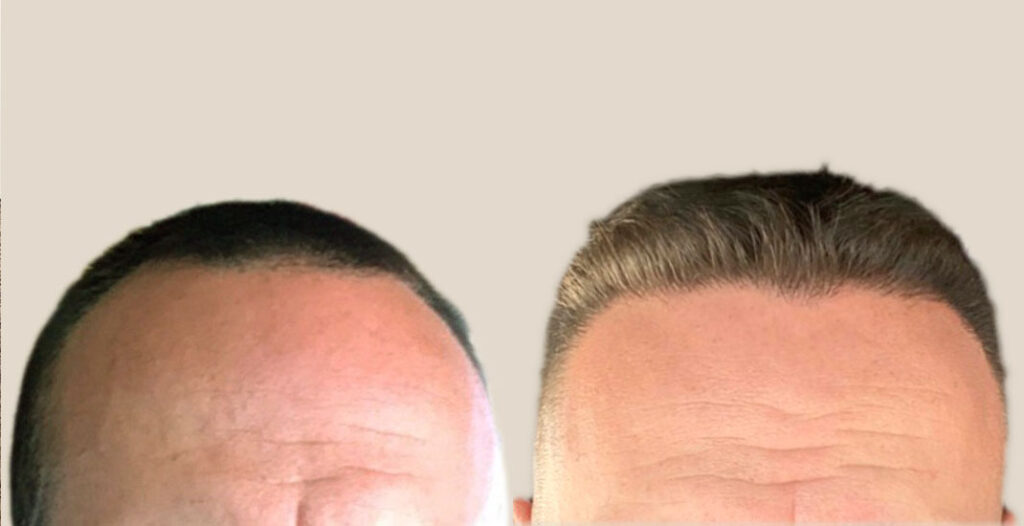 Nashville Hair Doctor gallery photo