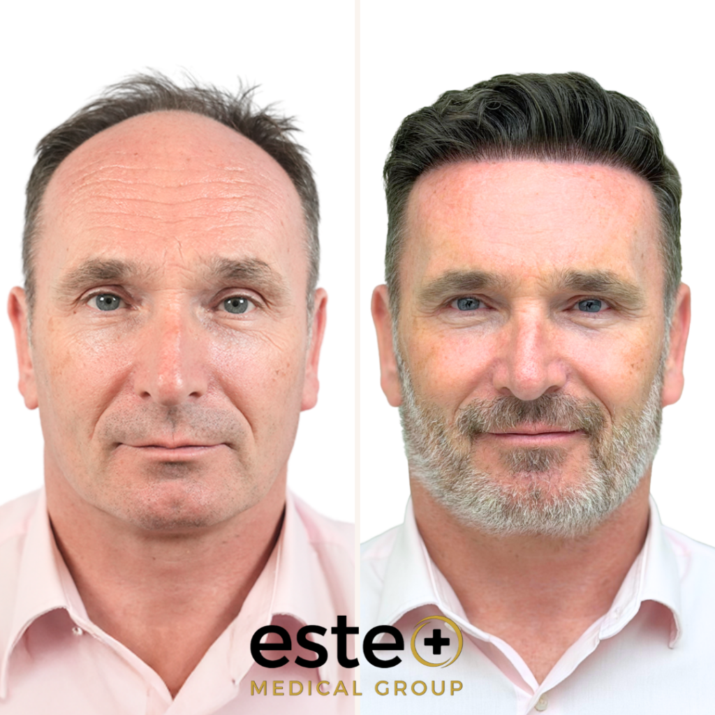 Este Medical Group- Hair & Skin Clinic Glasgow gallery photo