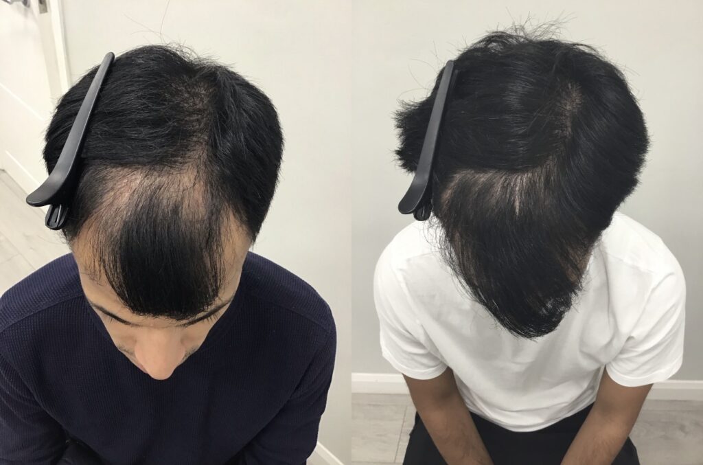 Este Hair Medical – Hair & Skin Clinic Nottingham gallery photo