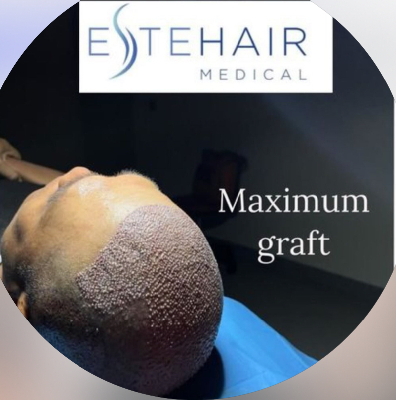 Este Hair Medical – Hair & Skin Clinic Nottingham gallery photo