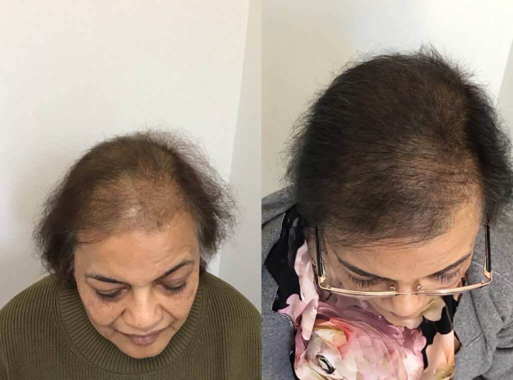 Este Hair Medical – Hair & Skin Clinic Nottingham gallery photo