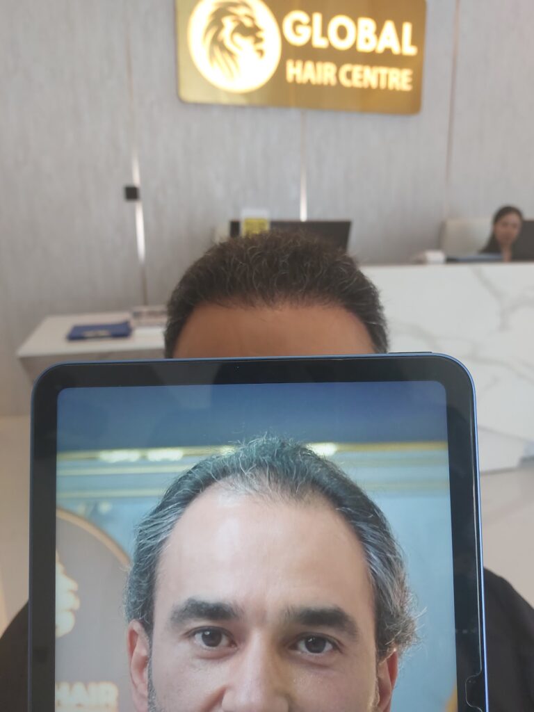 Global Hair Centre Dubai gallery photo