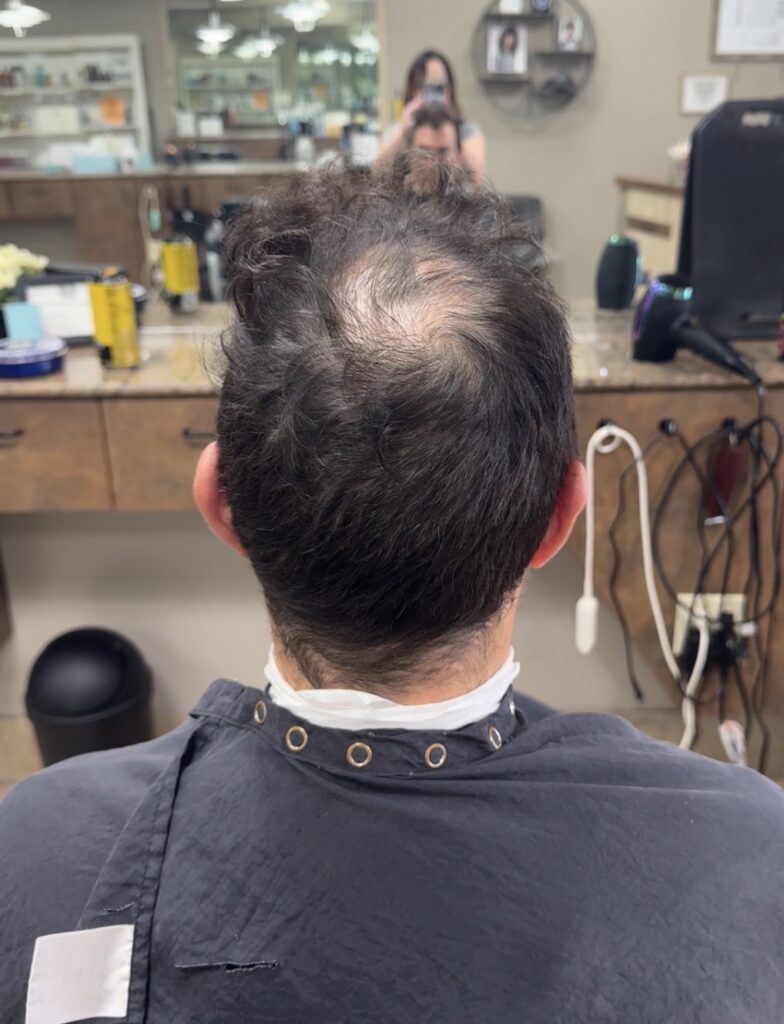 Maxim Hair Restoration & Transplants Austin gallery photo
