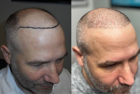 Hair Restoration Institute of DFW Fort Worth gallery photo