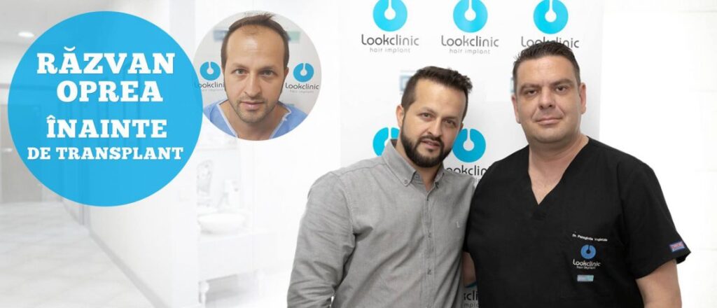 Hair Implant LookClinic gallery photo