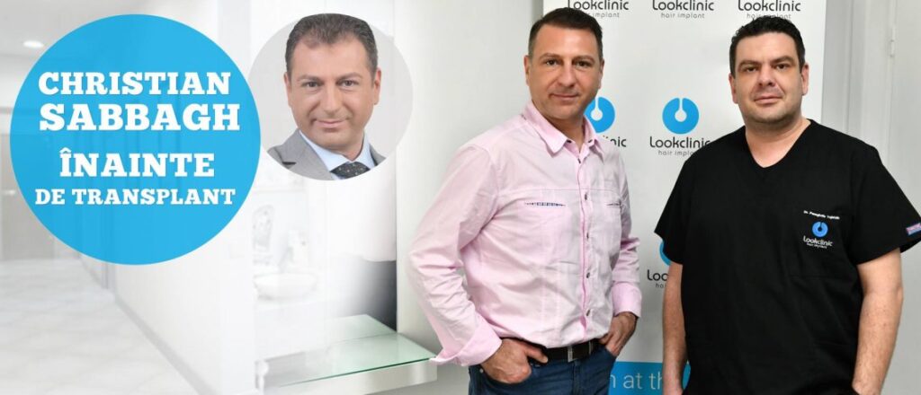 Hair Implant LookClinic gallery photo
