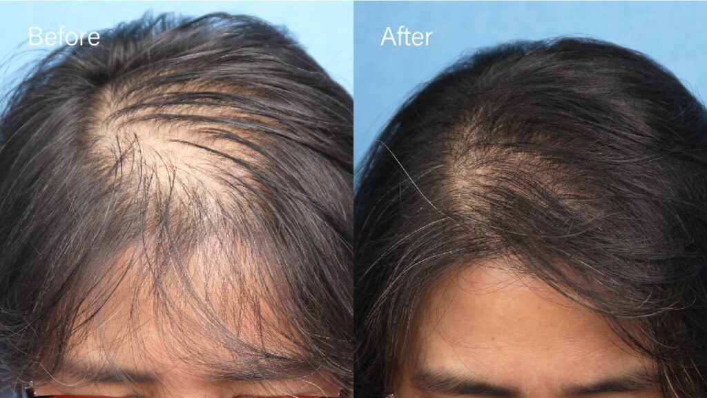 Moarm Hair Transplant Clinic Seoul gallery photo
