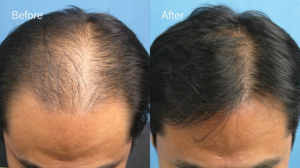 Moarm Hair Transplant Clinic Seoul gallery photo