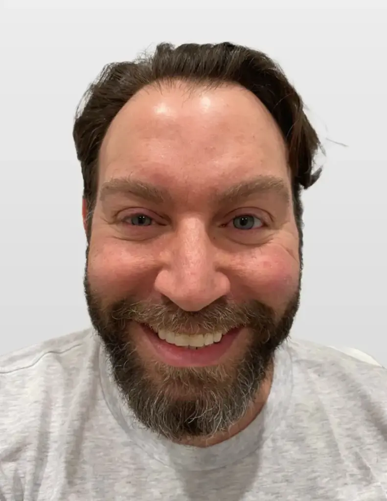 Moleno Hair Restoration gallery photo