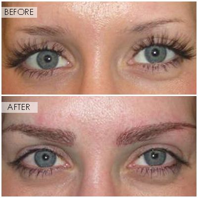 NeoGraft Hair Restoration Orange County gallery photo