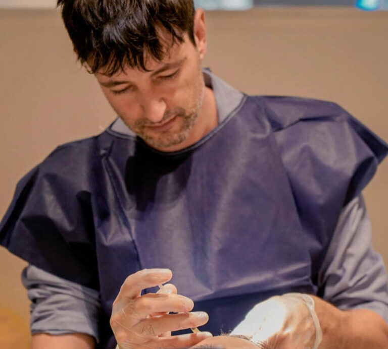 Dr. Dan Cots performing hair transplantation at Noan Clinic Barcelona