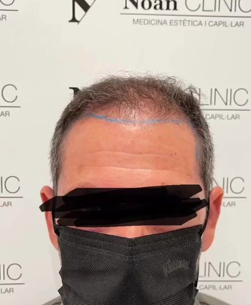 Noan Clinic Barcelona gallery photo