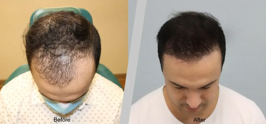 Francisco Sanchez-Navarro, MD Plastic Surgery gallery photo