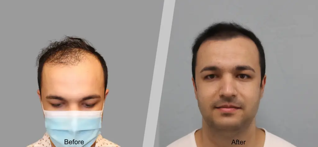 Francisco Sanchez-Navarro, MD Plastic Surgery gallery photo