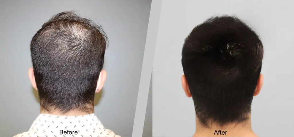 Francisco Sanchez-Navarro, MD Plastic Surgery gallery photo