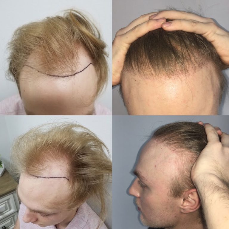 USA Hair Clinic gallery photo