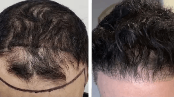 USA Hair Clinic gallery photo